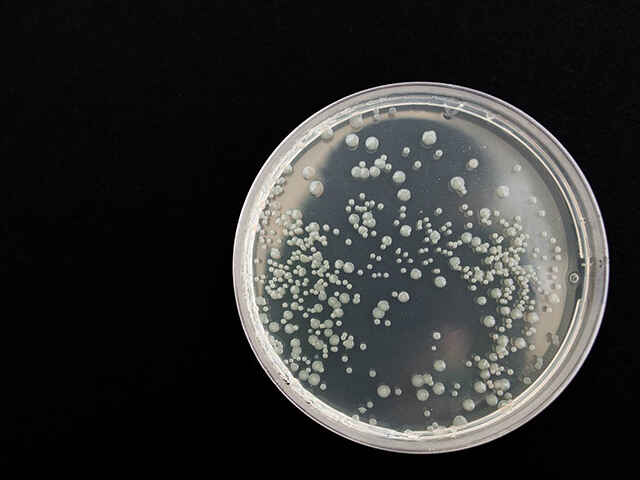 レジオネラ菌感染症の症状と対策法